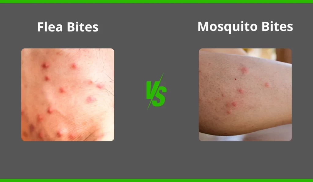 Flea Bites vs. Mosquito Bites